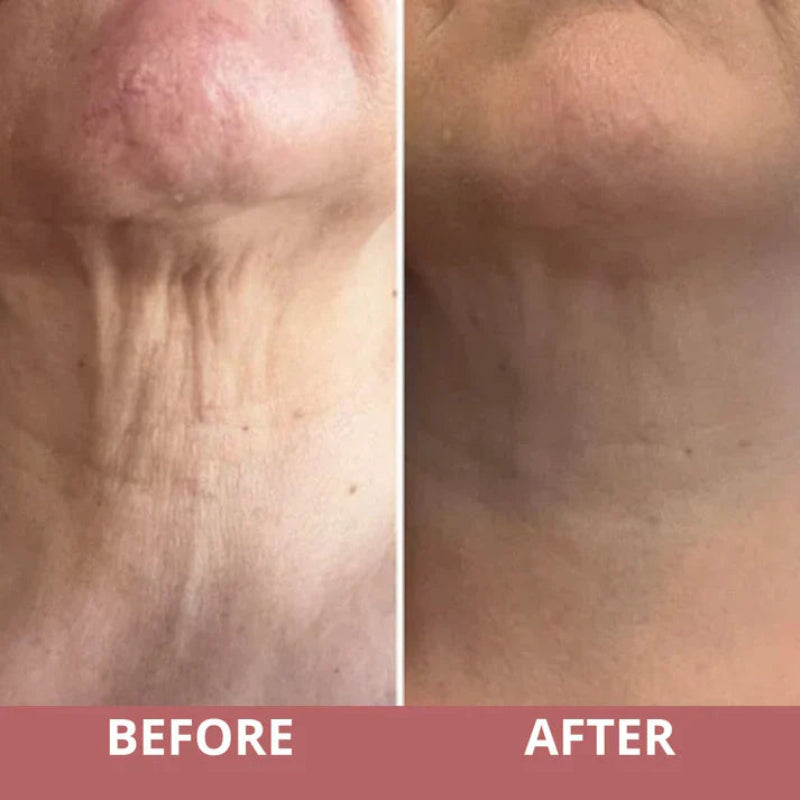 Straffende Halscreme mit Massageroller – Anti-Aging Halspflege
