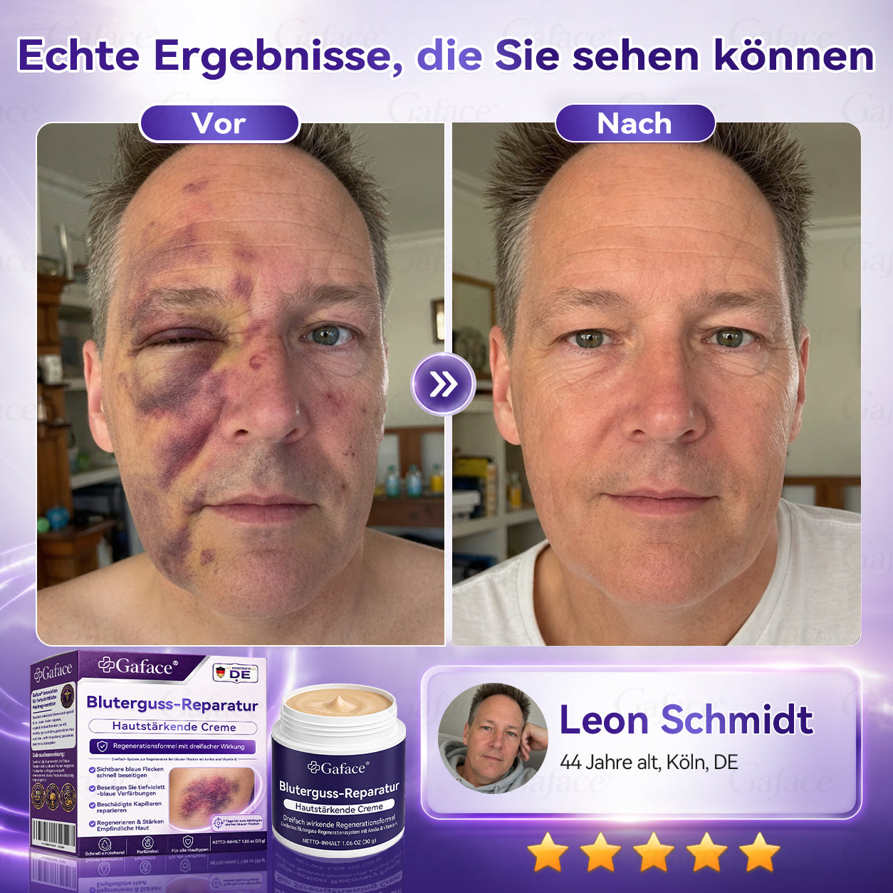 Vitamin K Creme mit Ringelblume für empfindliche & geschädigte Haut