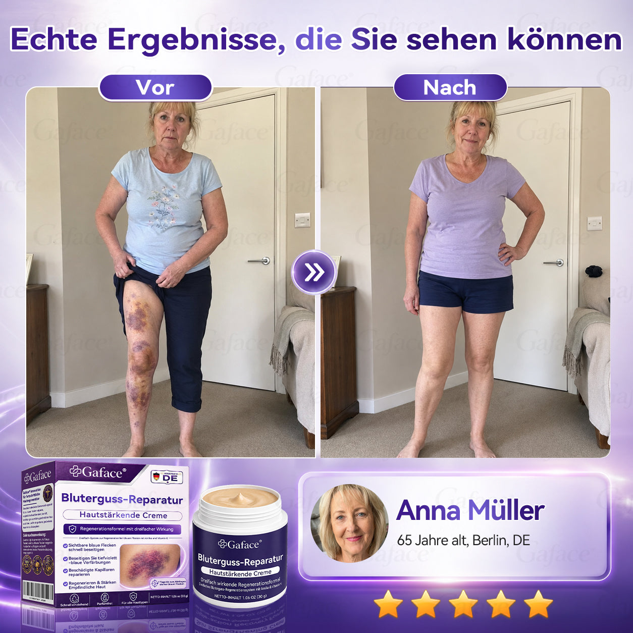 Vitamin K Creme mit Ringelblume für empfindliche & geschädigte Haut