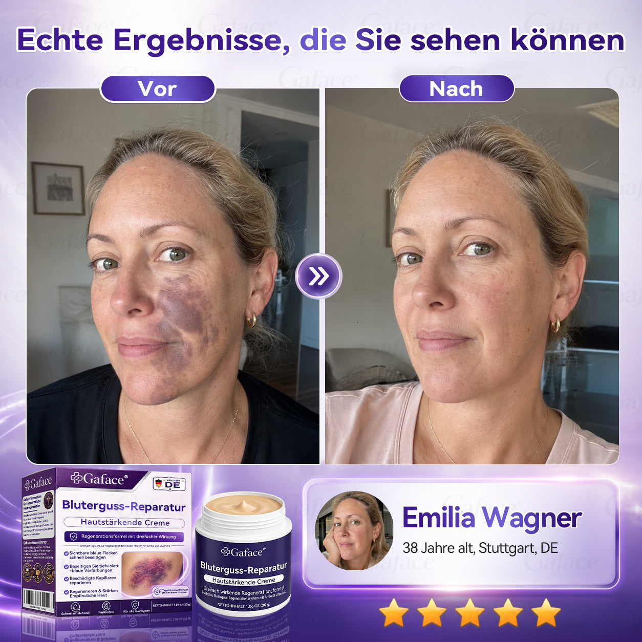 Vitamin K Creme mit Ringelblume für empfindliche & geschädigte Haut