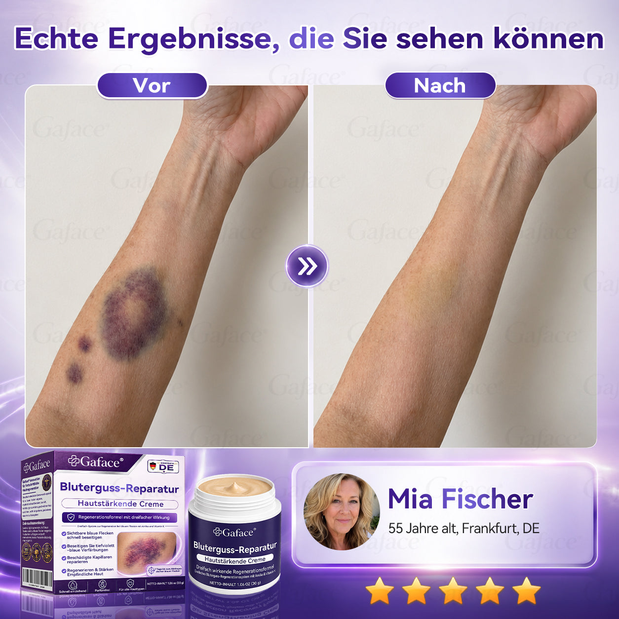Vitamin K Creme mit Ringelblume für empfindliche & geschädigte Haut