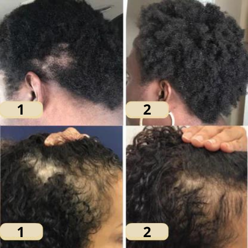 Natürliches Haaröl mit 11 Pflanzenölen für kräftiges Haarwachstum