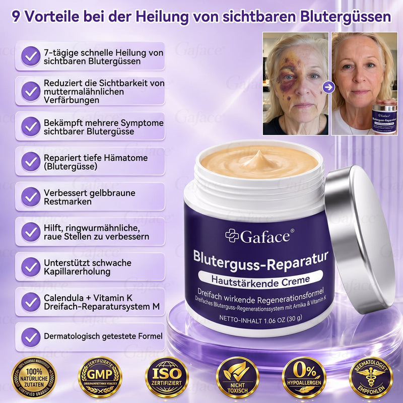 Vitamin K Creme mit Ringelblume für empfindliche & geschädigte Haut