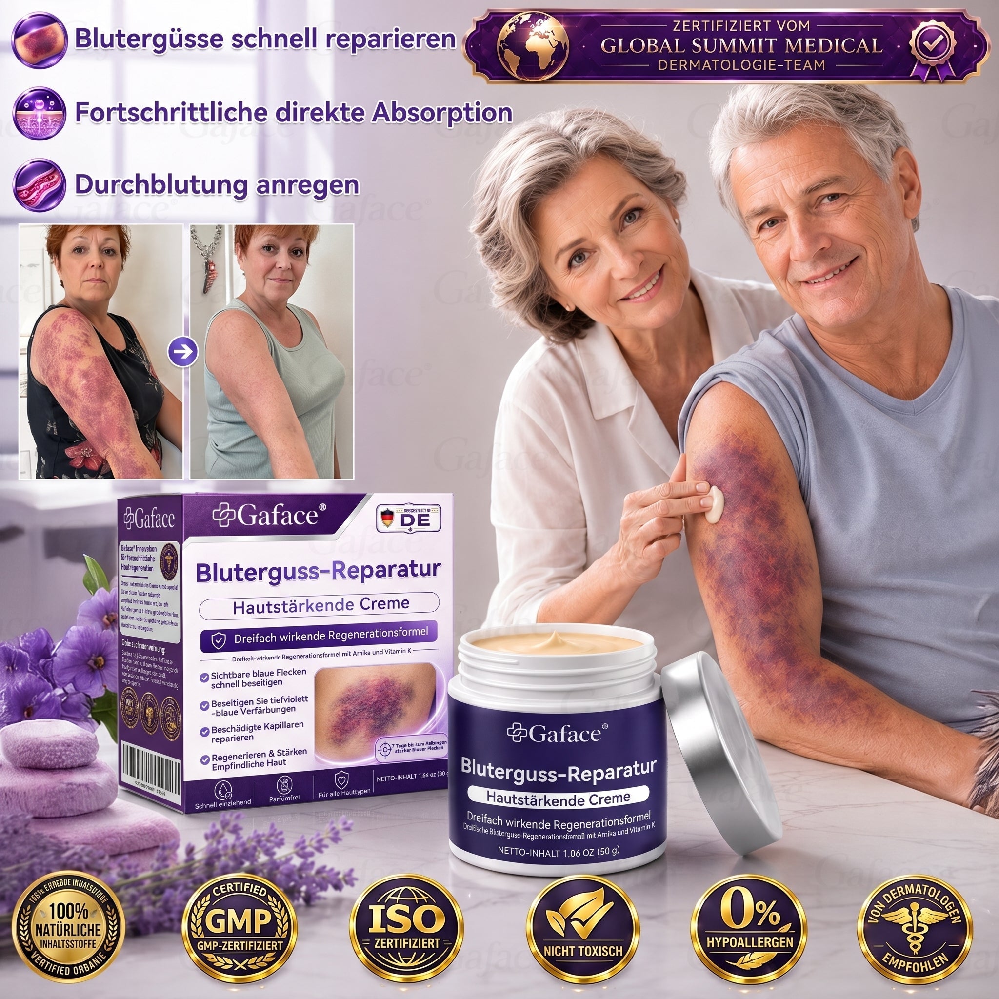 Vitamin K Creme mit Ringelblume für empfindliche & geschädigte Haut