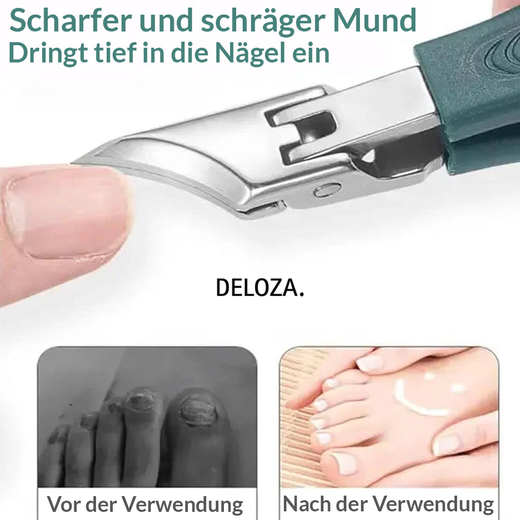 Nagelzangen Set für eingewachsene Nägel - 3-teilig mit gebogener Klinge