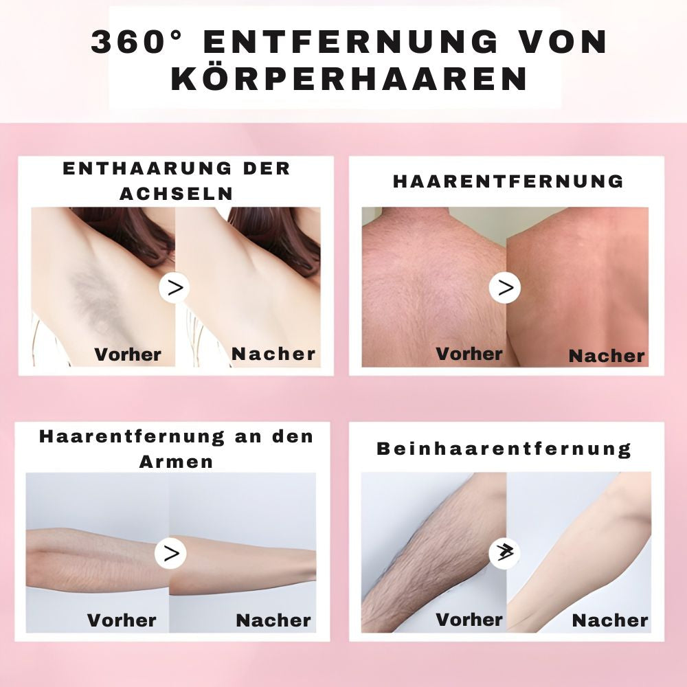 Haarentfernungsspray für sanfte Enthaarung ohne Rasieren 100ml