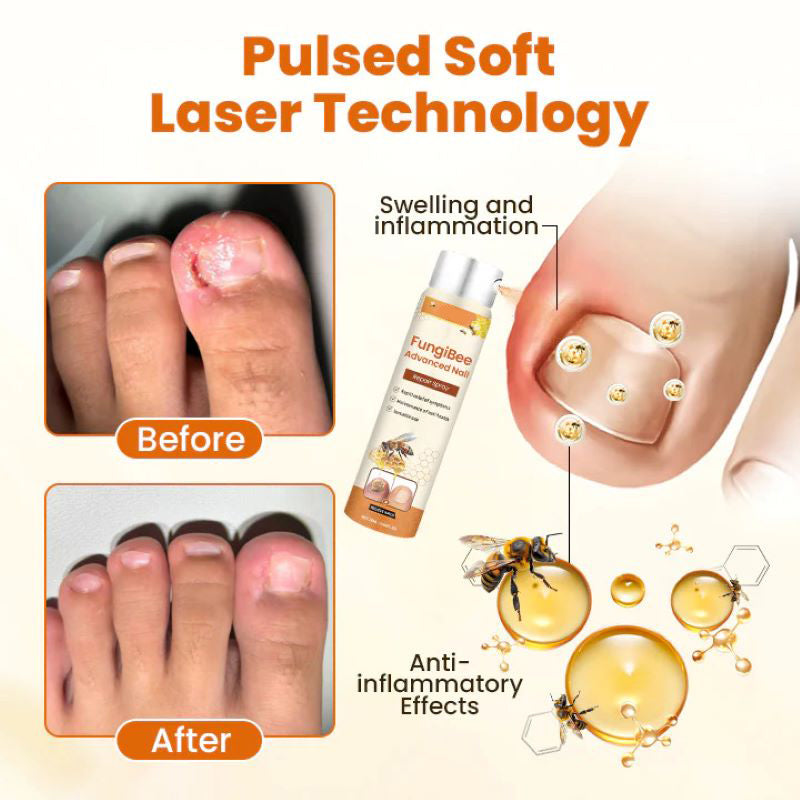 Nagelpflege Spray mit Bienengift - Stärkung für brüchige Nägel