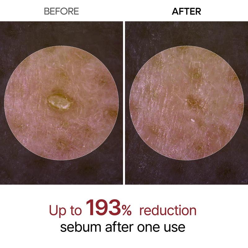Reis Peeling Set für Gesicht - Exfoliation mit Niacinamid 50ml
