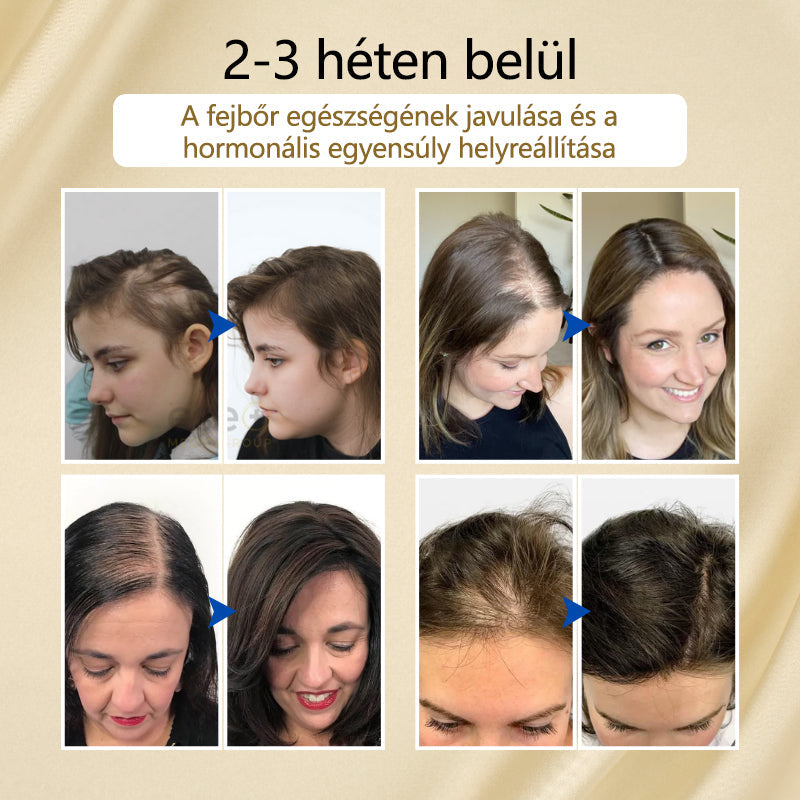 Biotin Haarwachstums Spray für dichtes und glänzendes Haar