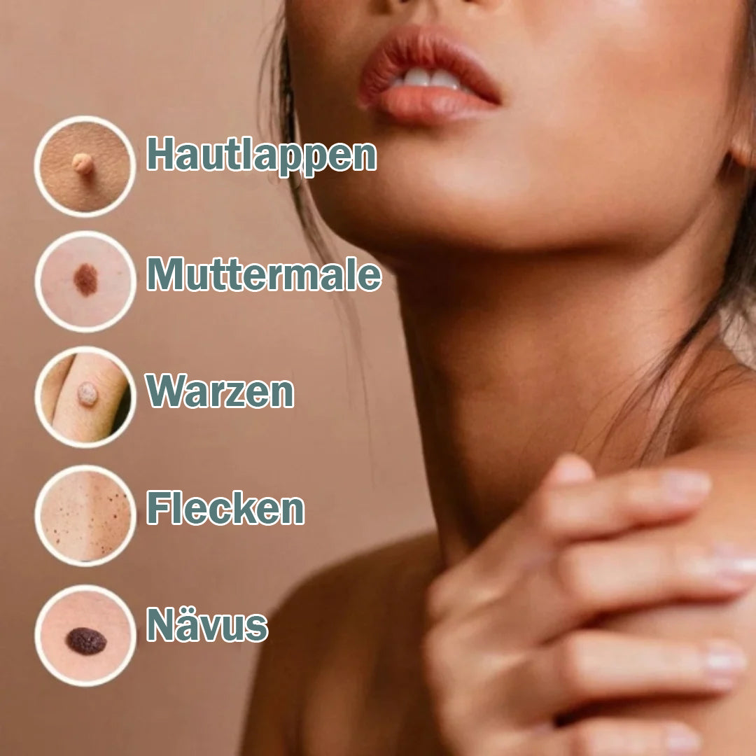 Hautanhängsel Entferner - Natürliche Lösung für Warzen und Muttermale