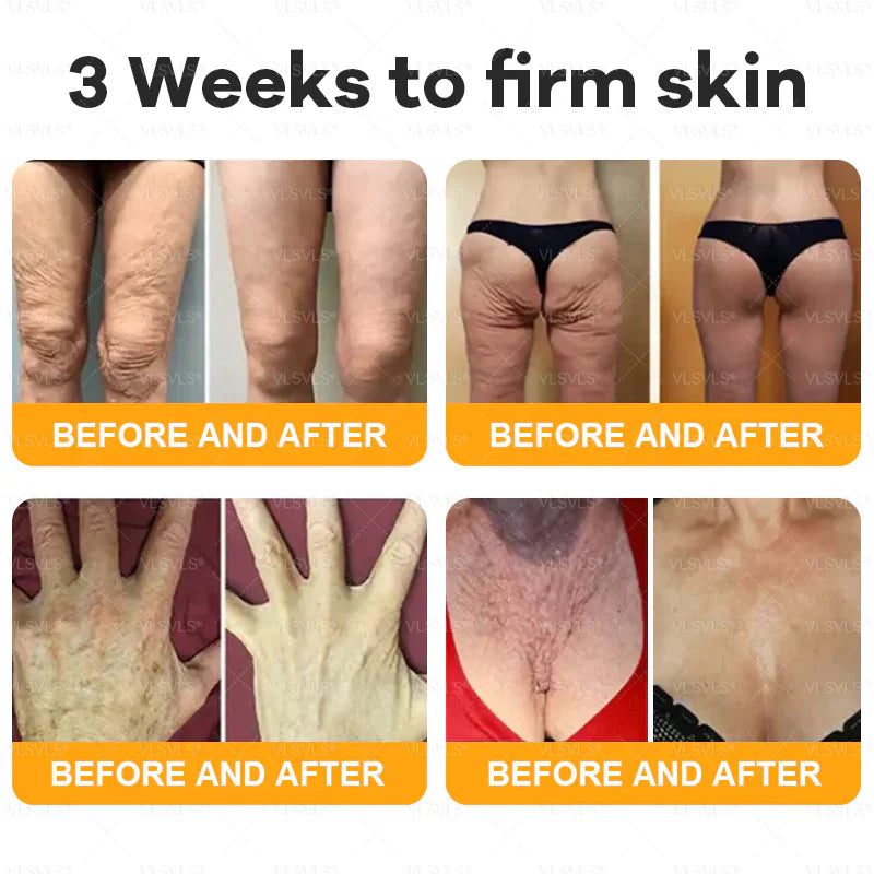 Anti-Aging Gesichtscreme mit Bienengift & Hyaluronsäure - 30g