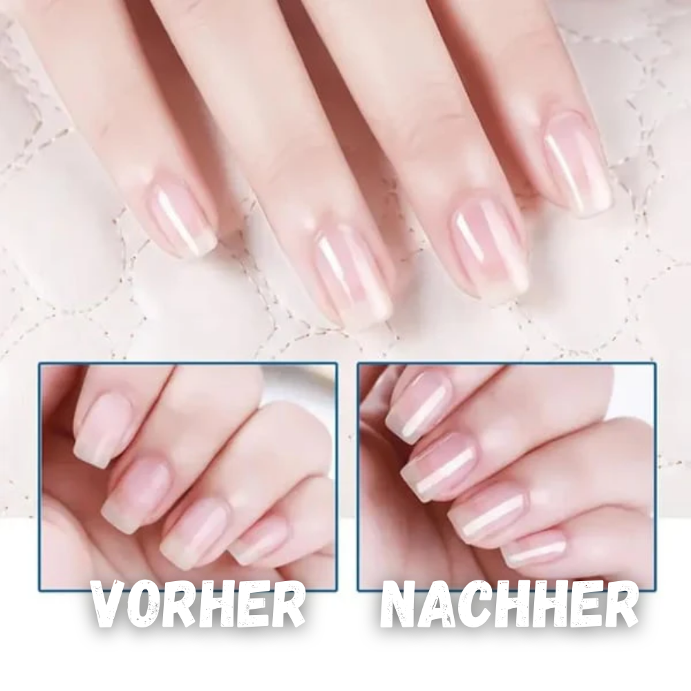 Nagelpflegeöl für glänzende und gesunde Nägel - Nagelhautpflege