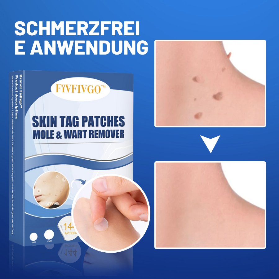 Warzen Entfernung Pflaster mit Tea Tree Öl - Hautpflaster Set