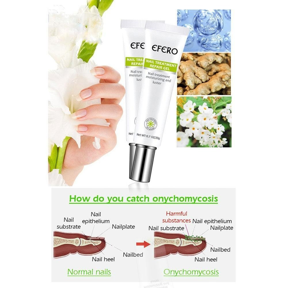 Nagelpflege Gel gegen Pilz - Stärkung und Regeneration für Nägel