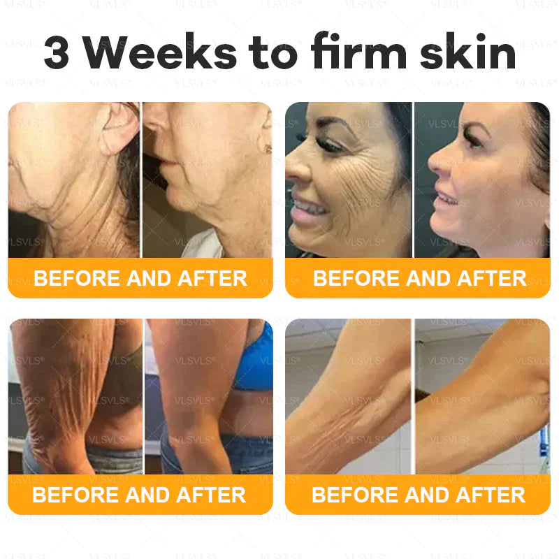Anti-Aging Gesichtscreme mit Bienengift & Hyaluronsäure - 30g