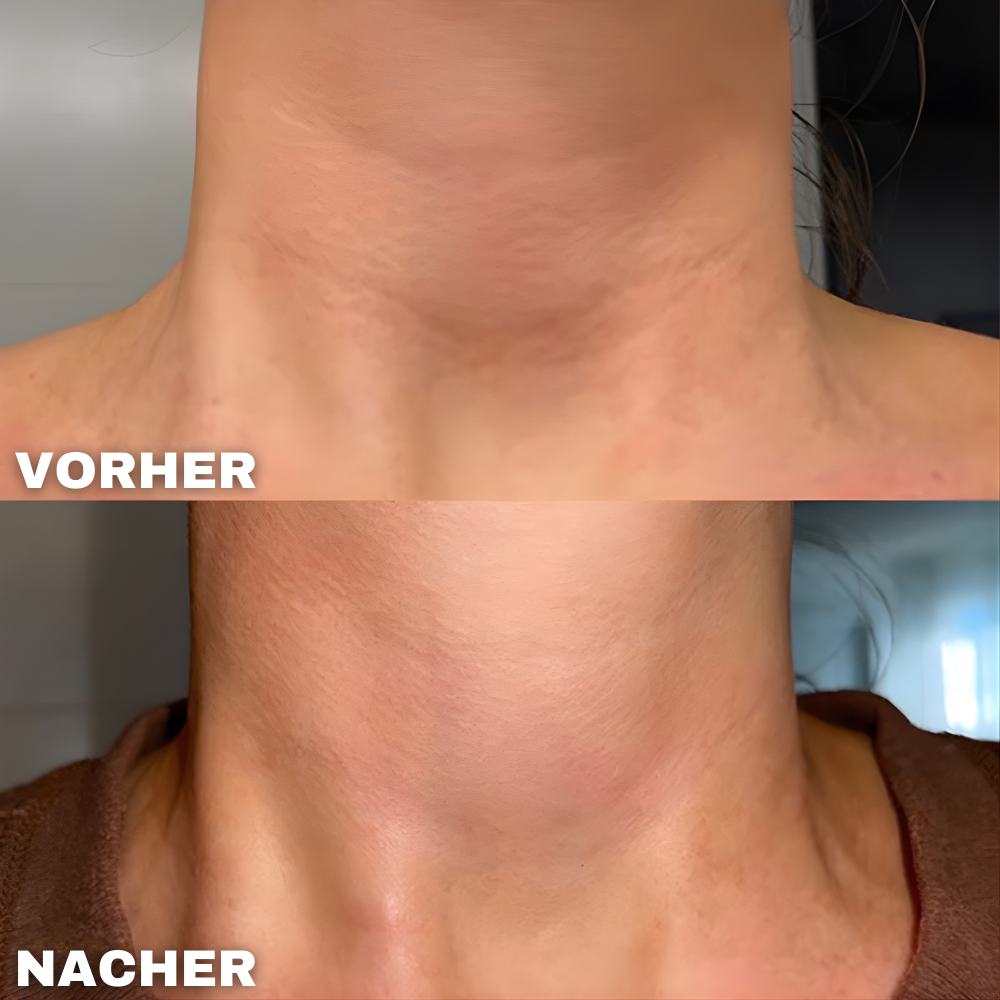 Silikon Hals Glättungspad - Anti-Aging Hautpflege für die Nacht