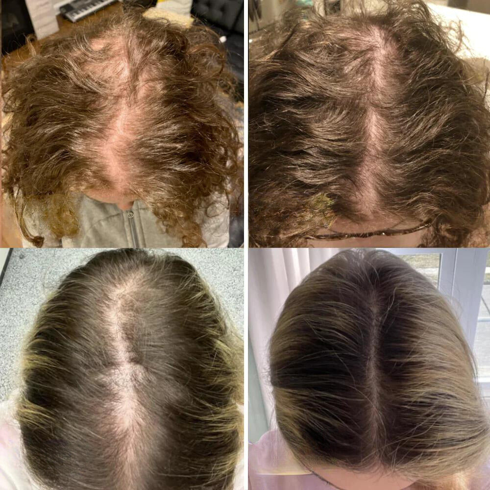 Natürliches Haaröl mit 11 Pflanzenölen für kräftiges Haarwachstum