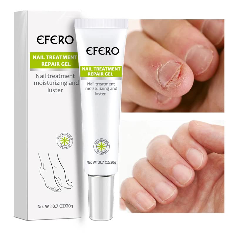 Nagelpflege Gel gegen Pilz - Stärkung und Regeneration für Nägel