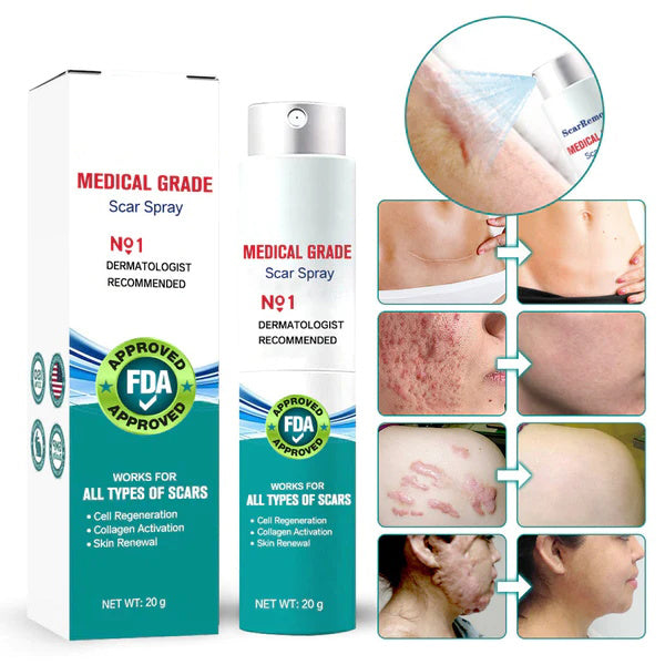 Narben Spray für empfindliche Haut - Hautpflege mit Aloe Vera