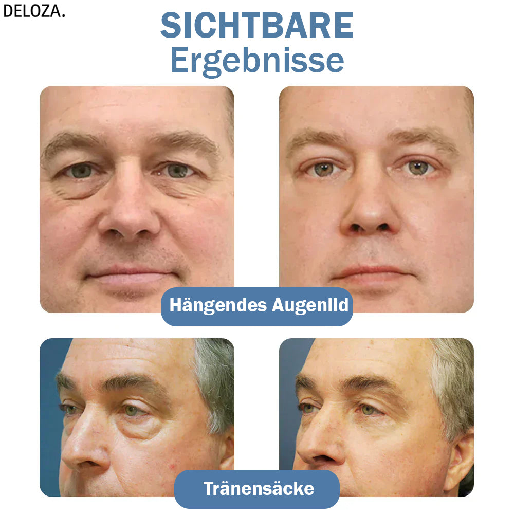 Augencreme gegen Augenringe und Tränensäcke für Männer und Frauen