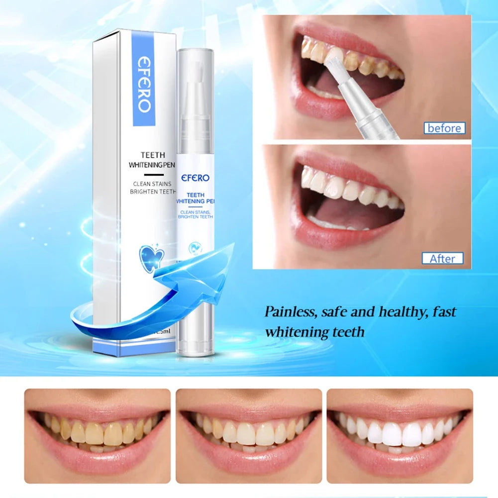 Zahnaufhellung Stift - Teeth Whitening Pen für weiße Zähne
