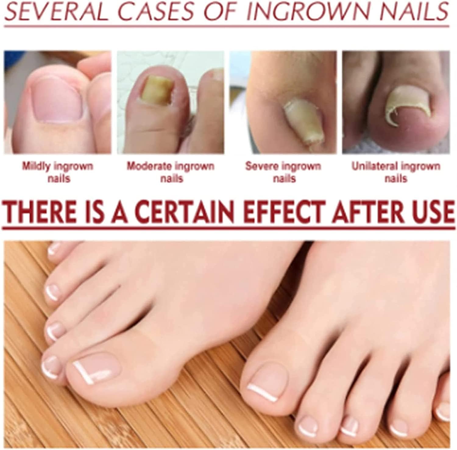 Nagelpflege Tropfen für brüchige Nägel - Intensivpflege Hände & Füße