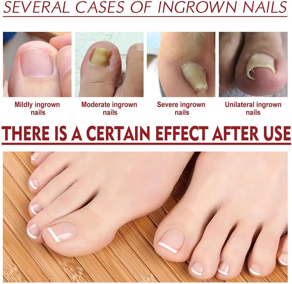 Nagelpflege Set für brüchige Nägel - Stärkung & Regeneration