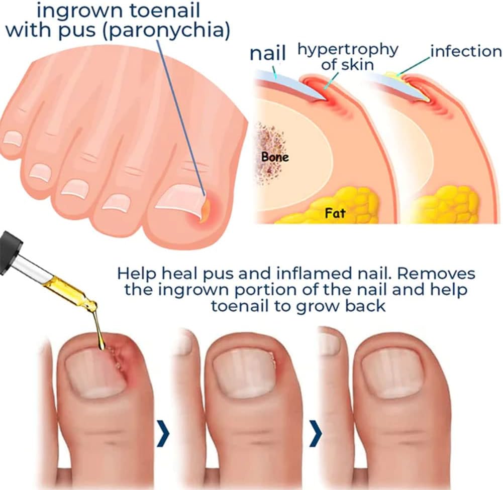 Nagelpflege Set für brüchige Nägel - Stärkung & Regeneration