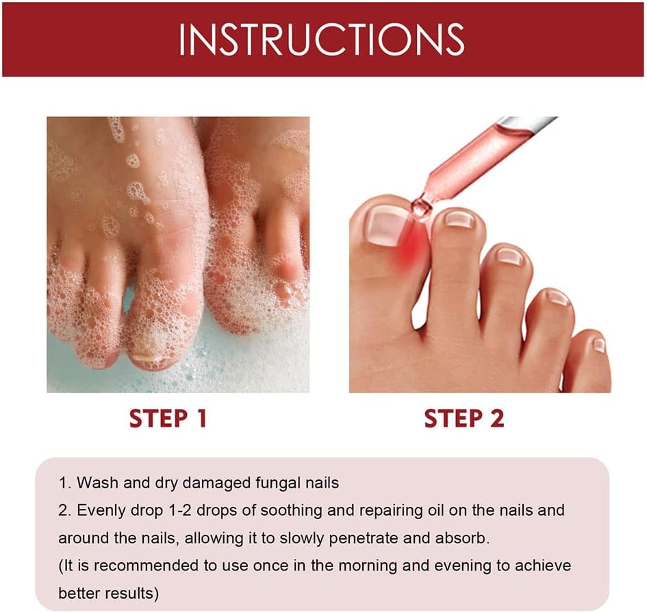 Nagelpflege Set für brüchige Nägel - Stärkung & Regeneration