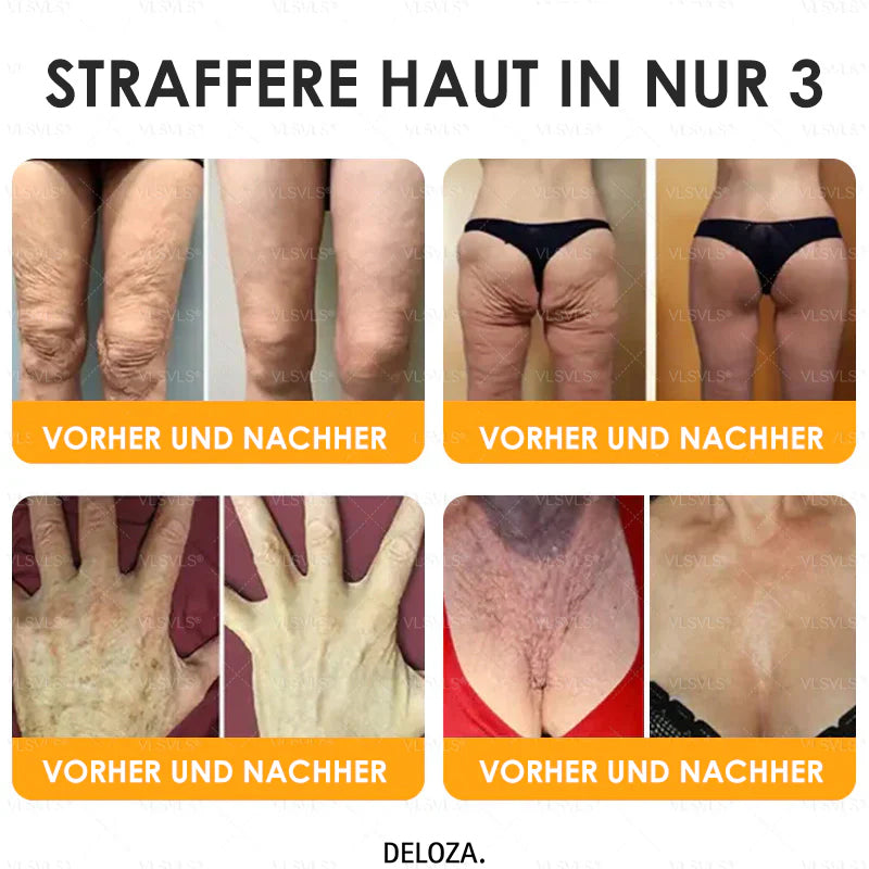 Anti-Aging-Creme mit Bienengift Peptiden und Hyaluronsäure