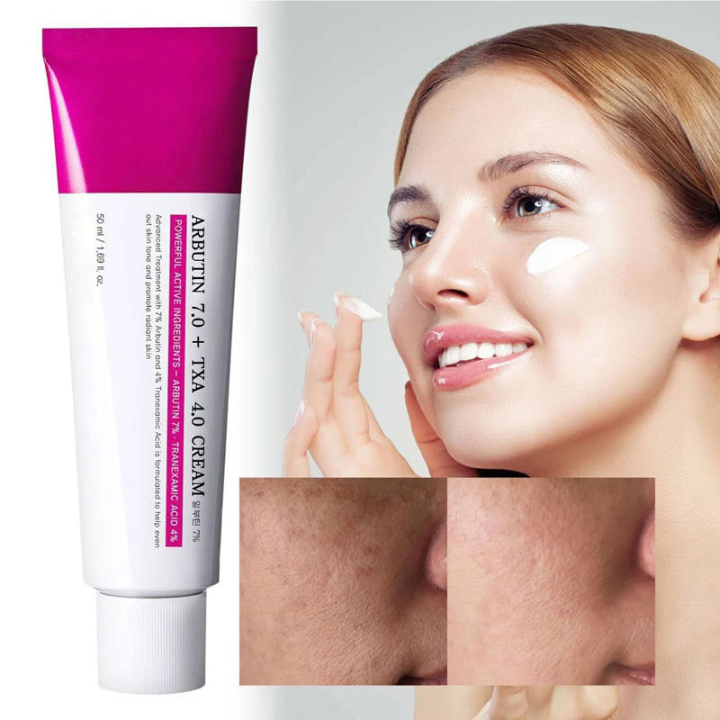 Anti-Pigmentflecken Creme mit Arbutin - Aufhellende Gesichtspflege