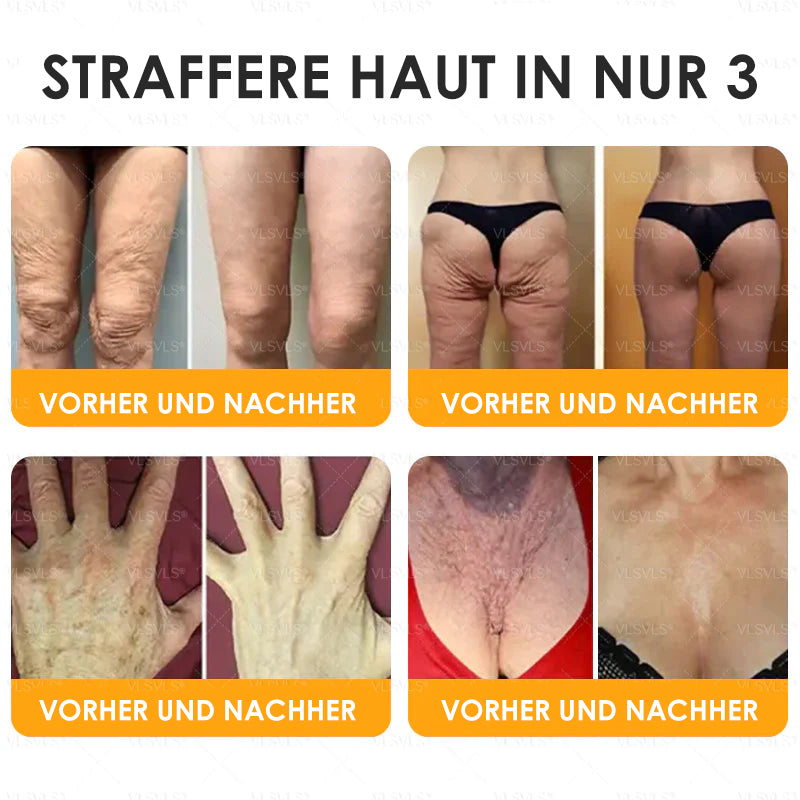 Anti-Aging Creme mit Bienengift Peptiden und Hyaluronsäure