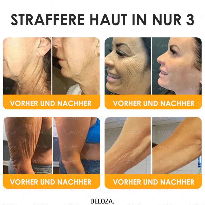 Anti-Aging-Creme mit Bienengift Peptiden und Hyaluronsäure