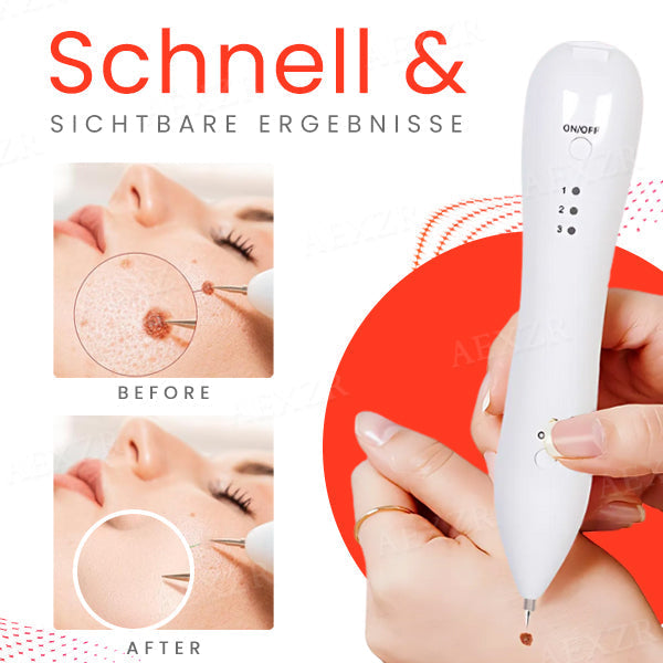 Laser Hautpflege Stift für Pigmentflecken und Hautunreinheiten