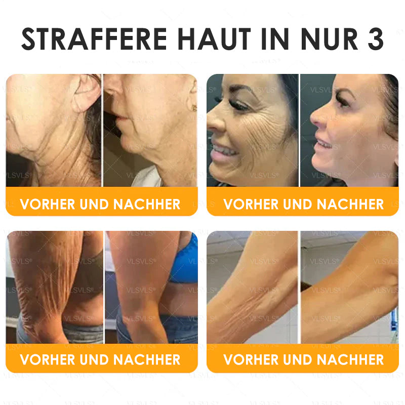 Anti-Aging Creme mit Bienengift Peptiden und Hyaluronsäure