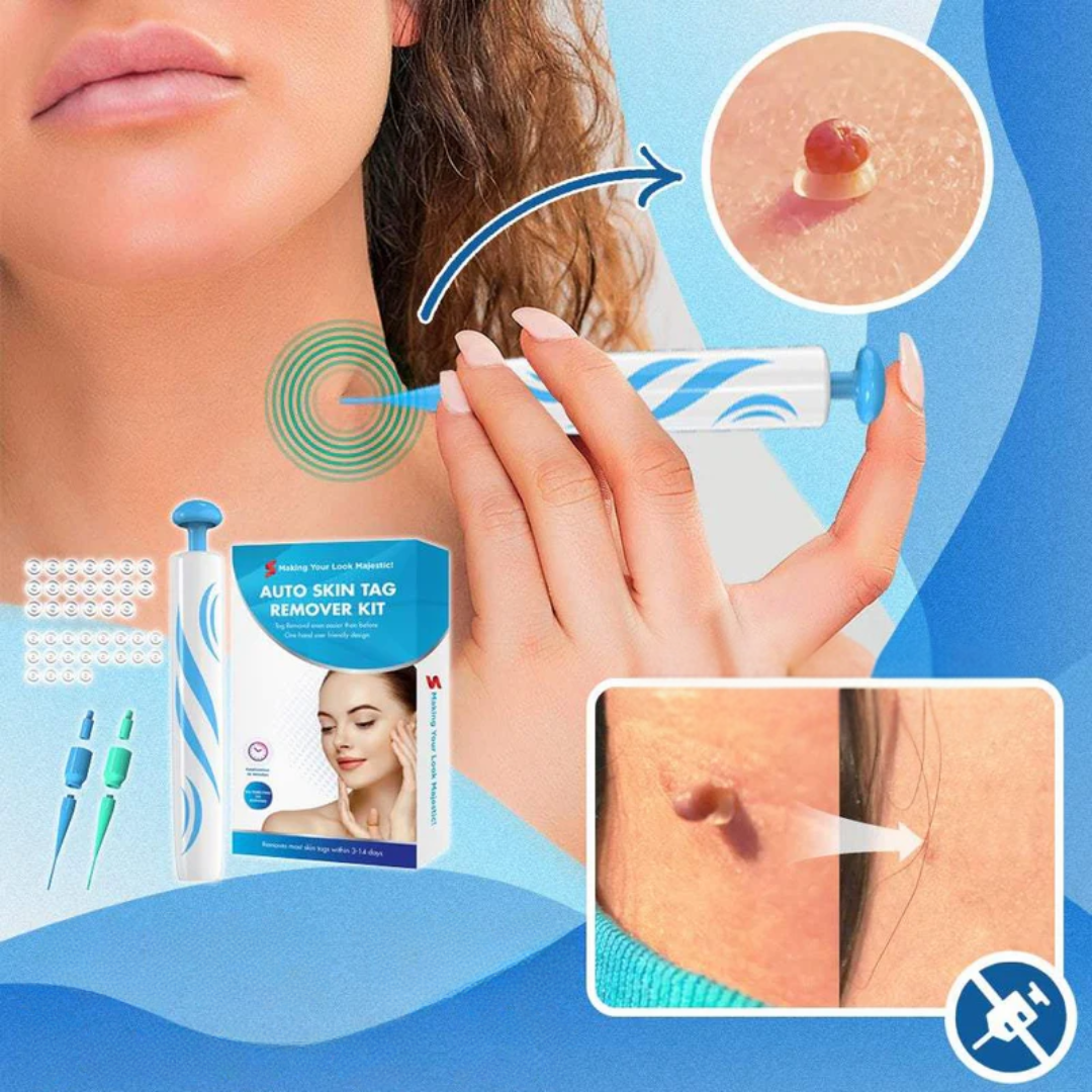 Warzenentferner Lösung 20ml - sanfte Hautpflege für glatte Haut