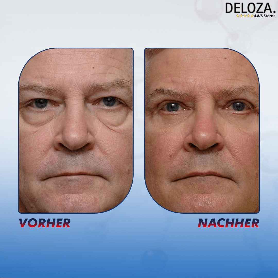 Augencreme mit Peptiden gegen Augenringe & Fältchen - Anti Aging Gel
