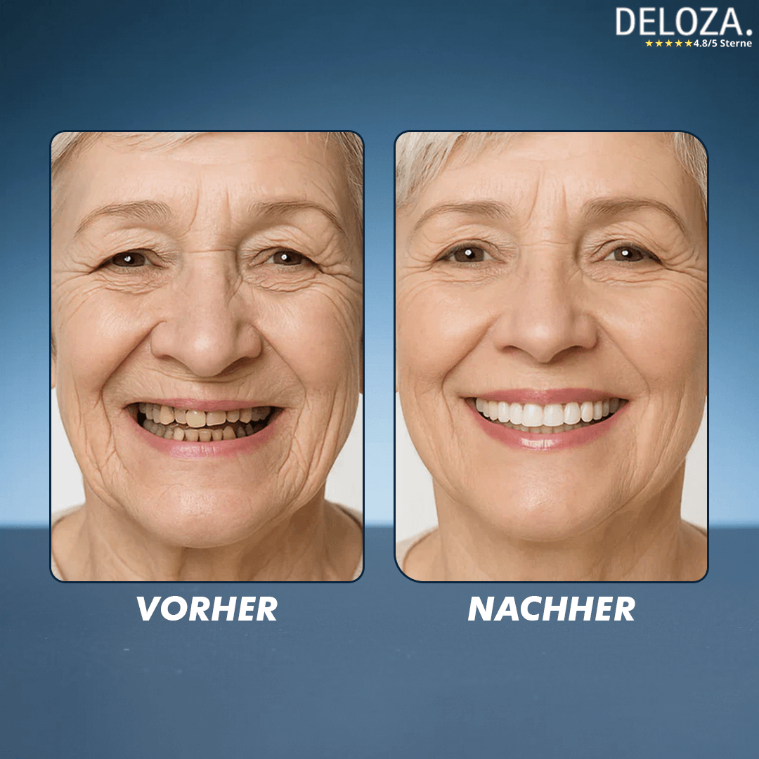 Flexible Zahnprothese Set Ober- & Unterkiefer aus weichem Silikon