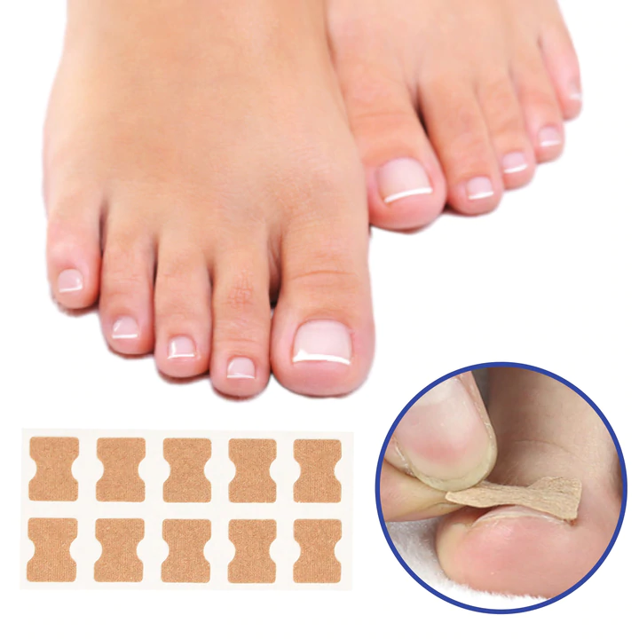 Nagelkorrektur Pads für eingewachsene Nägel - Nagelpflege Set