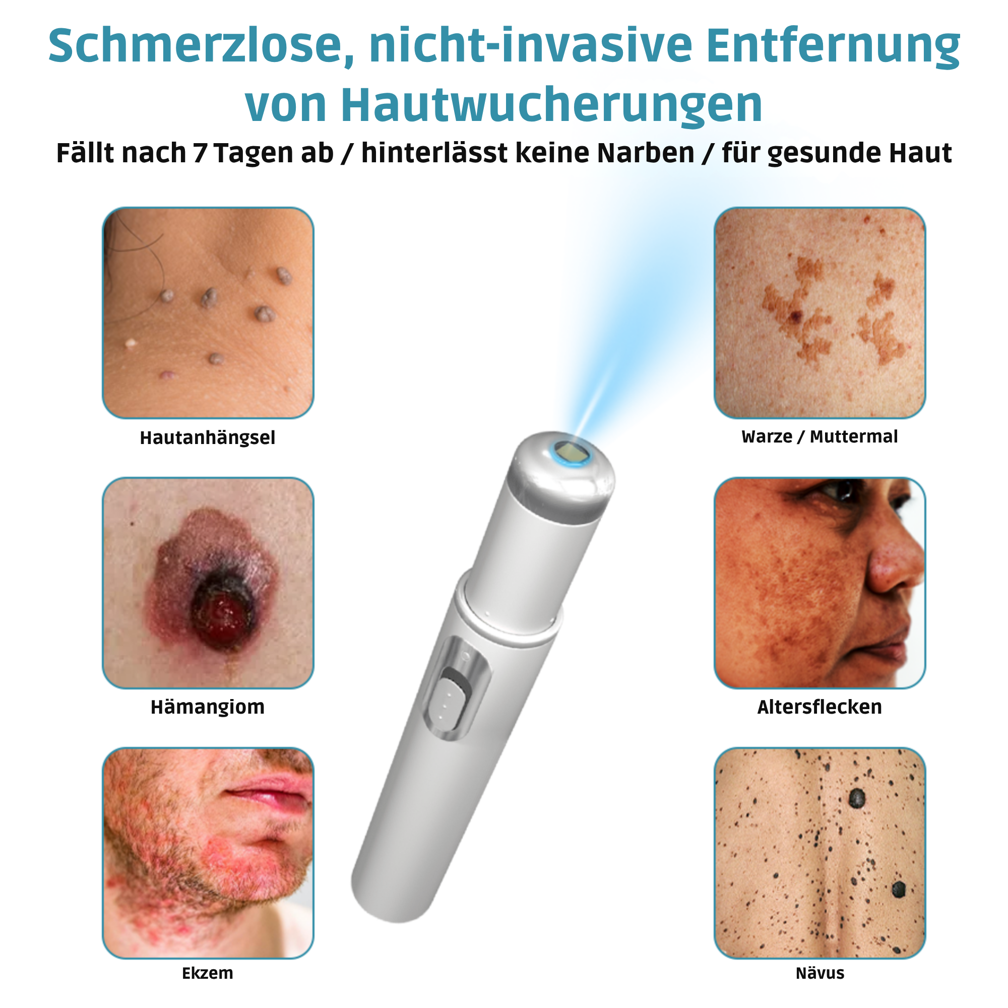 Kosmetisches Hautpflegegerät für die tägliche Anwendung zu Hause