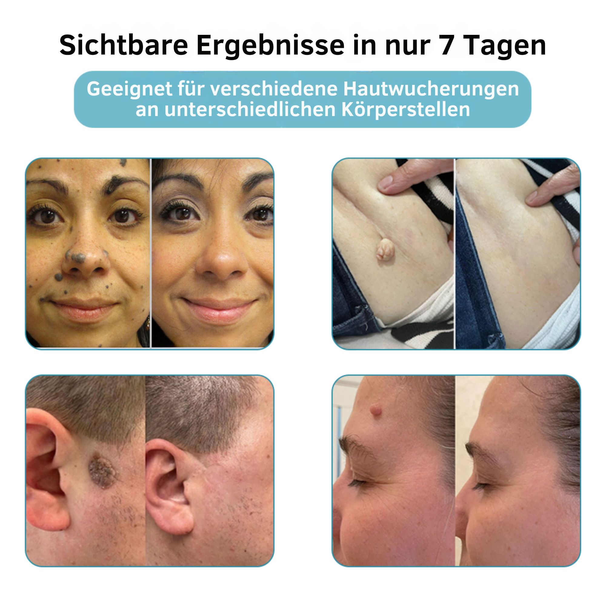 Kosmetisches Hautpflegegerät für die tägliche Anwendung zu Hause