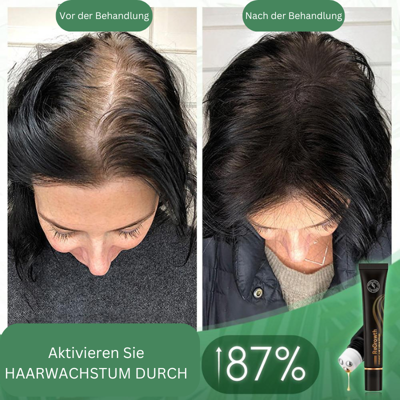 Bio Haar Serum Roller – Natürliche Kräuterformel für Volumen & Dichte