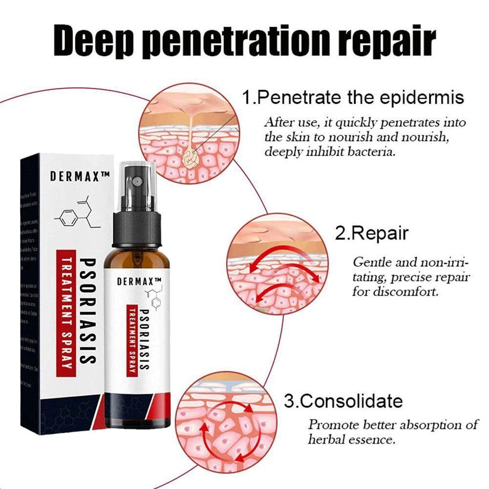 Hautpflege Spray gegen Juckreiz und Schuppenbildung 50ml