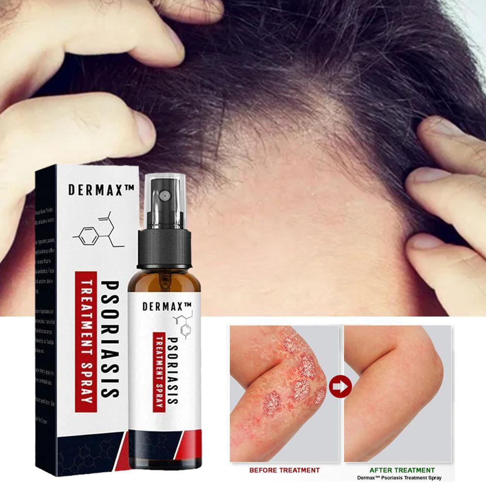 Hautpflege Spray gegen Juckreiz und Schuppenbildung 50ml