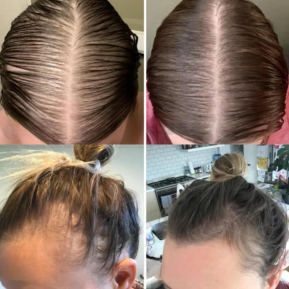 Natürliches Haaröl mit 11 Pflanzenölen für kräftiges Haarwachstum