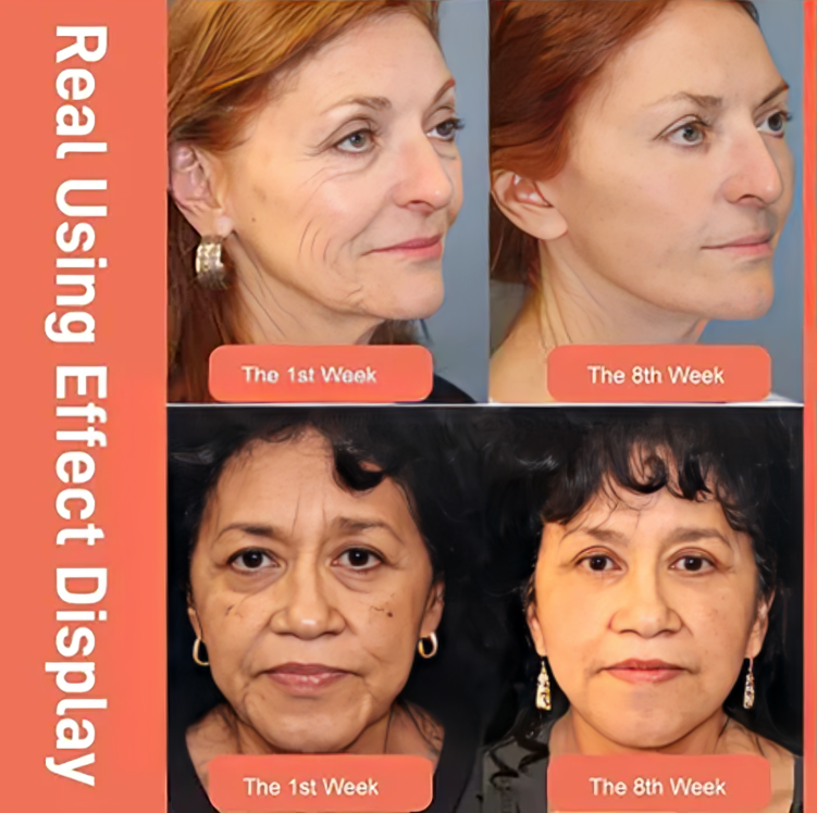 Anti Aging Creme mit Retinol und Hyaluronsäure 50ml
