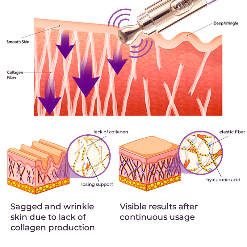 Hochfrequenz Serum Stift für Anti-Aging und Kollagenbildung