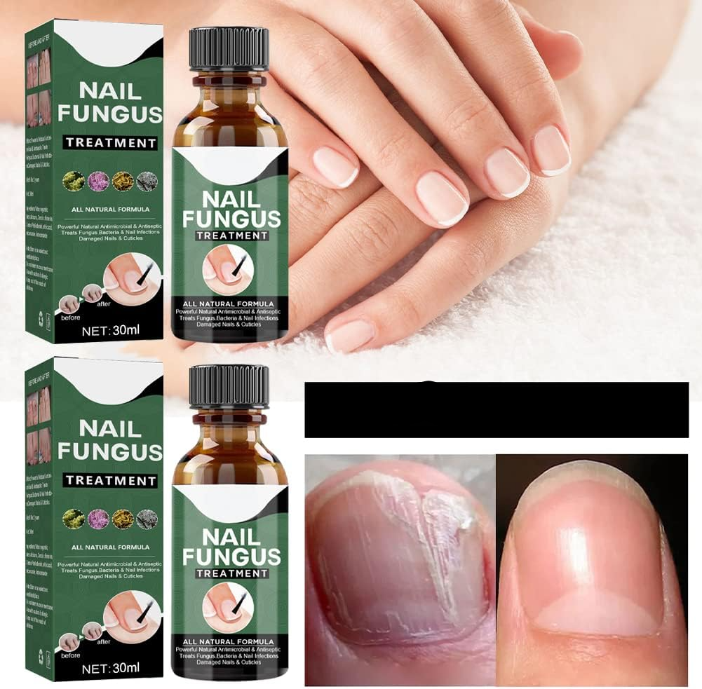 Nagelpilz Reparaturserum – Pflegeserum für gesunde & gepflegte Nägel