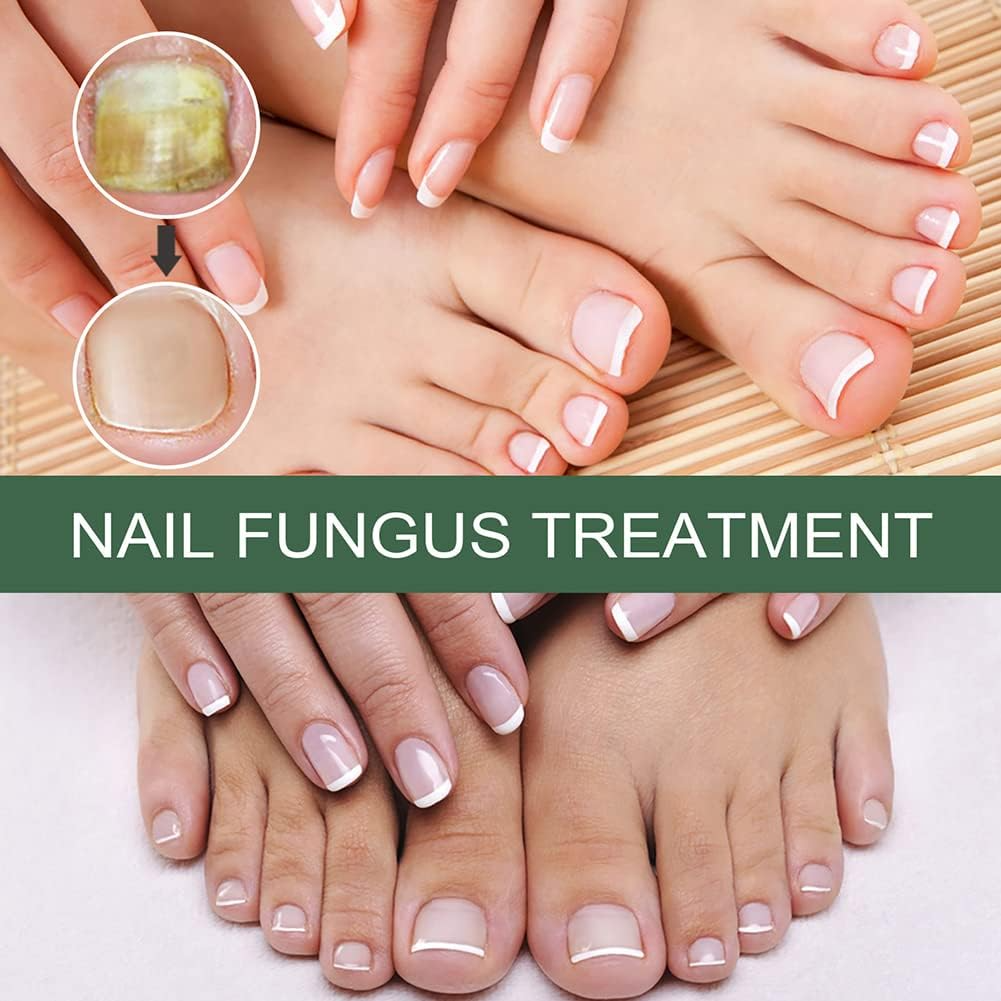 Nagelpilz Reparaturserum – Pflegeserum für gesunde & gepflegte Nägel