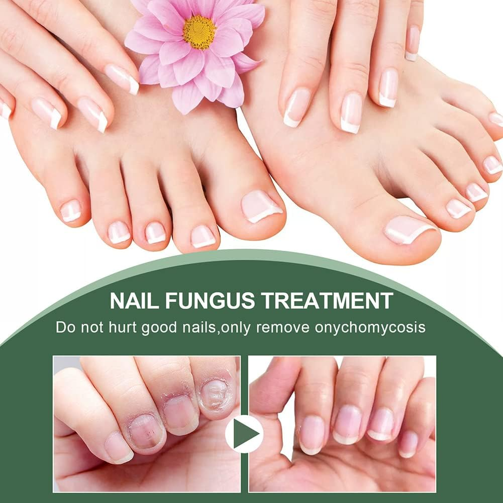 Nagelpilz Reparaturserum – Pflegeserum für gesunde & gepflegte Nägel